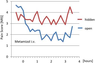 Nocebo Effects and Negative Suggestions in Daily Clinical Practice – Forms, Impact and Approaches to Avoid Them